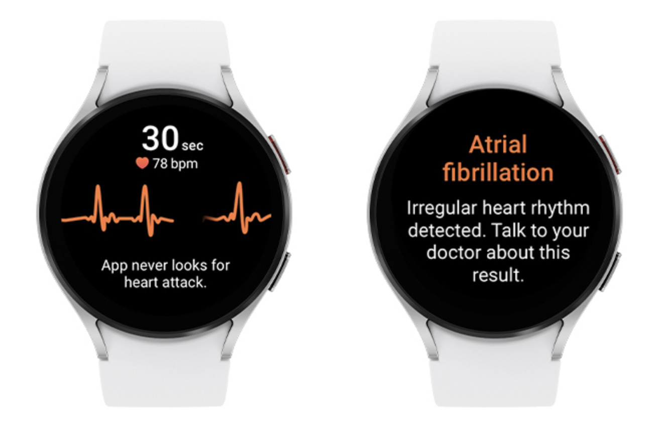Your Samsung Watch can Before long Caution You of Irregular Heart Rhythms